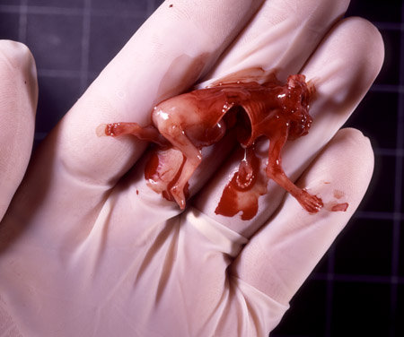 11 week aborted fetus t